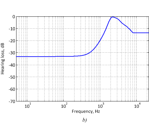 Speech signal: initial